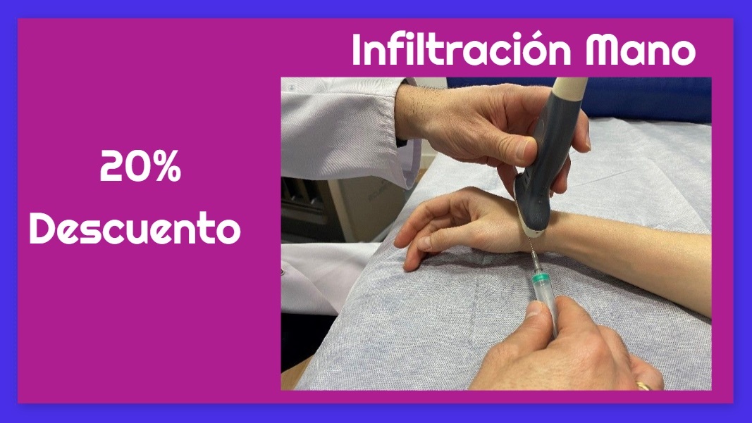 artroscopia en mano